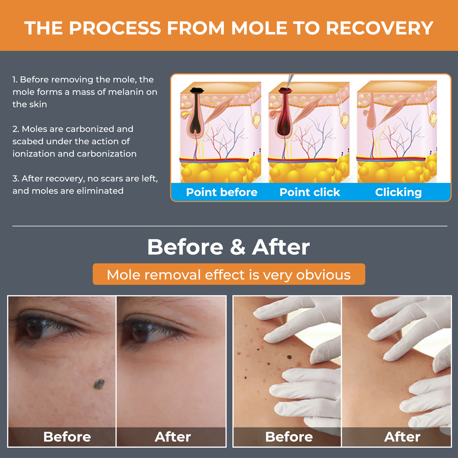 Cross-border 15-grade mole removal pen, a special beauty device for removing spots and moles, laser picosecond mole scanning pen pic 6