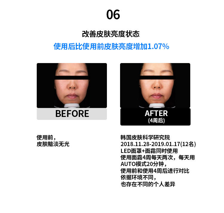 Facial color light home beauty device, red and blue LED beauty mask, skin rejuvenation mask device, home beauty device pic 28