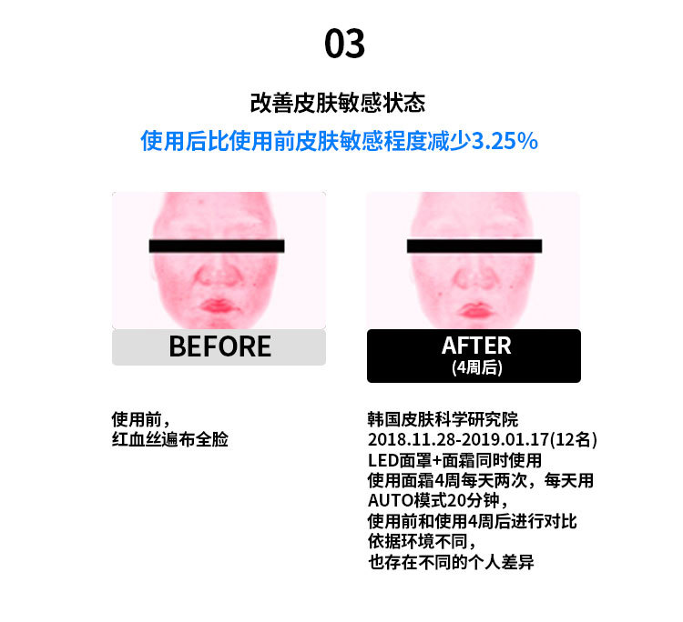 Facial color light home beauty device, red and blue LED beauty mask, skin rejuvenation mask device, home beauty device pic 25