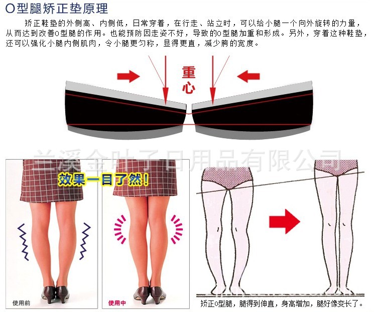 O-shaped leg insoles, heel inversion pads, ankle insoles, foot inversion pads (for women) pic 4