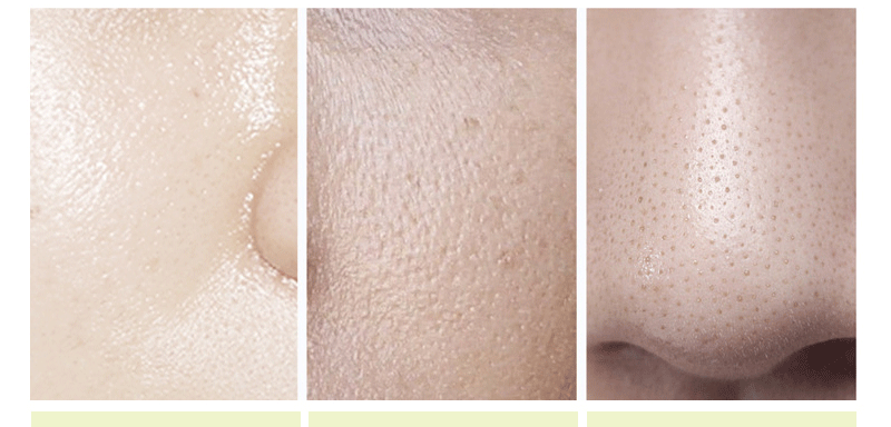 Dear She跨境牛奶吸黑头粉刺面膜膜去黑头鼻膜吸黑头撕拉式面膜详情4