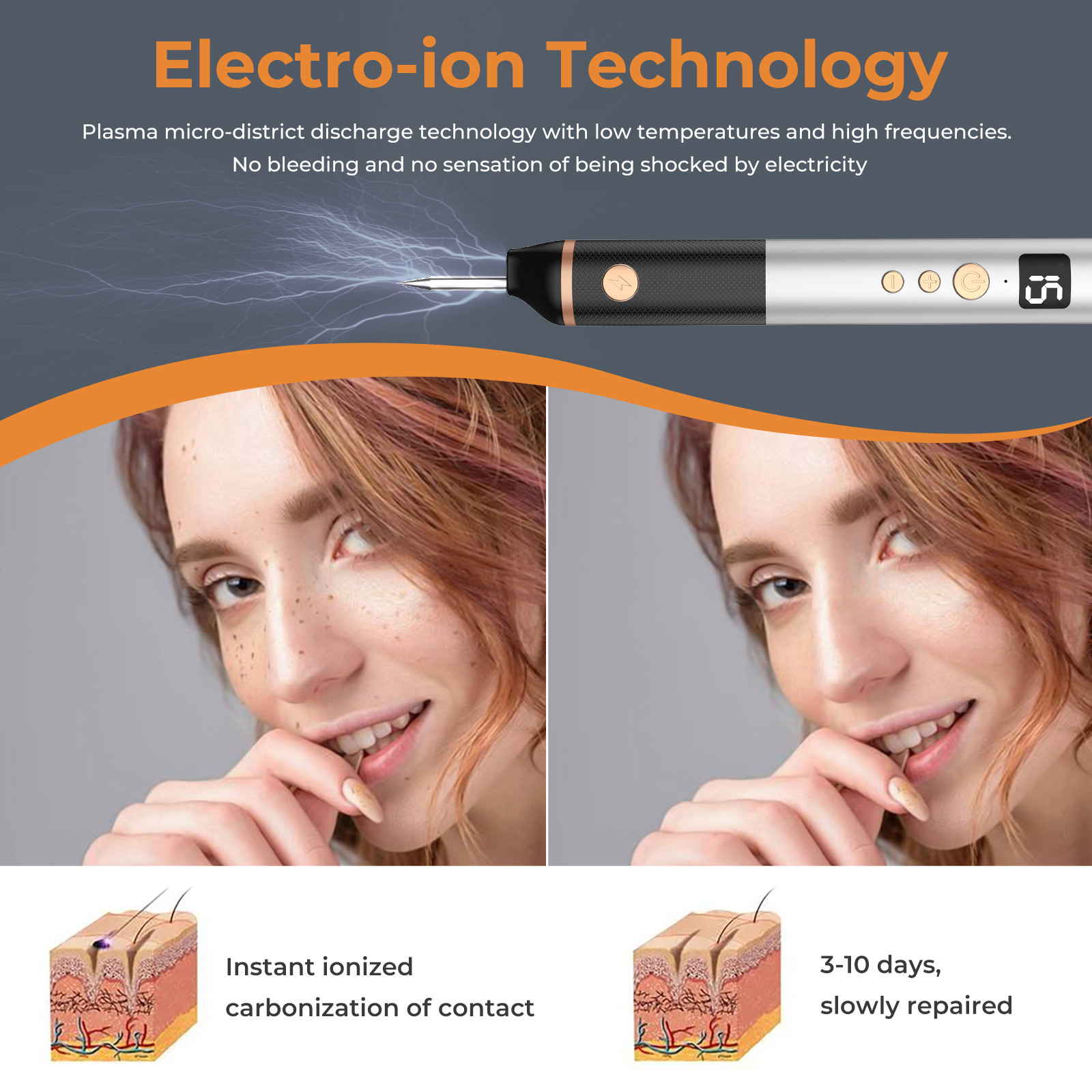 Cross-border 15-grade mole removal pen, a special beauty device for removing spots and moles, laser picosecond mole scanning pen pic 7