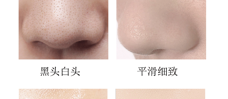 Dear She跨境牛奶吸黑头粉刺面膜膜去黑头鼻膜吸黑头撕拉式面膜详情15