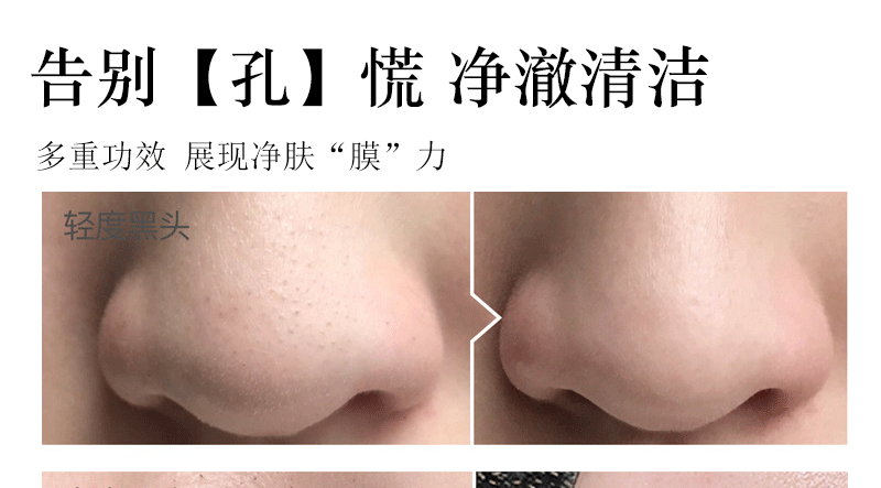 Dear She Avocado Mask, peel-off head Mask/Nose mask, clean pores, absorb oil, cross-border export pic 12