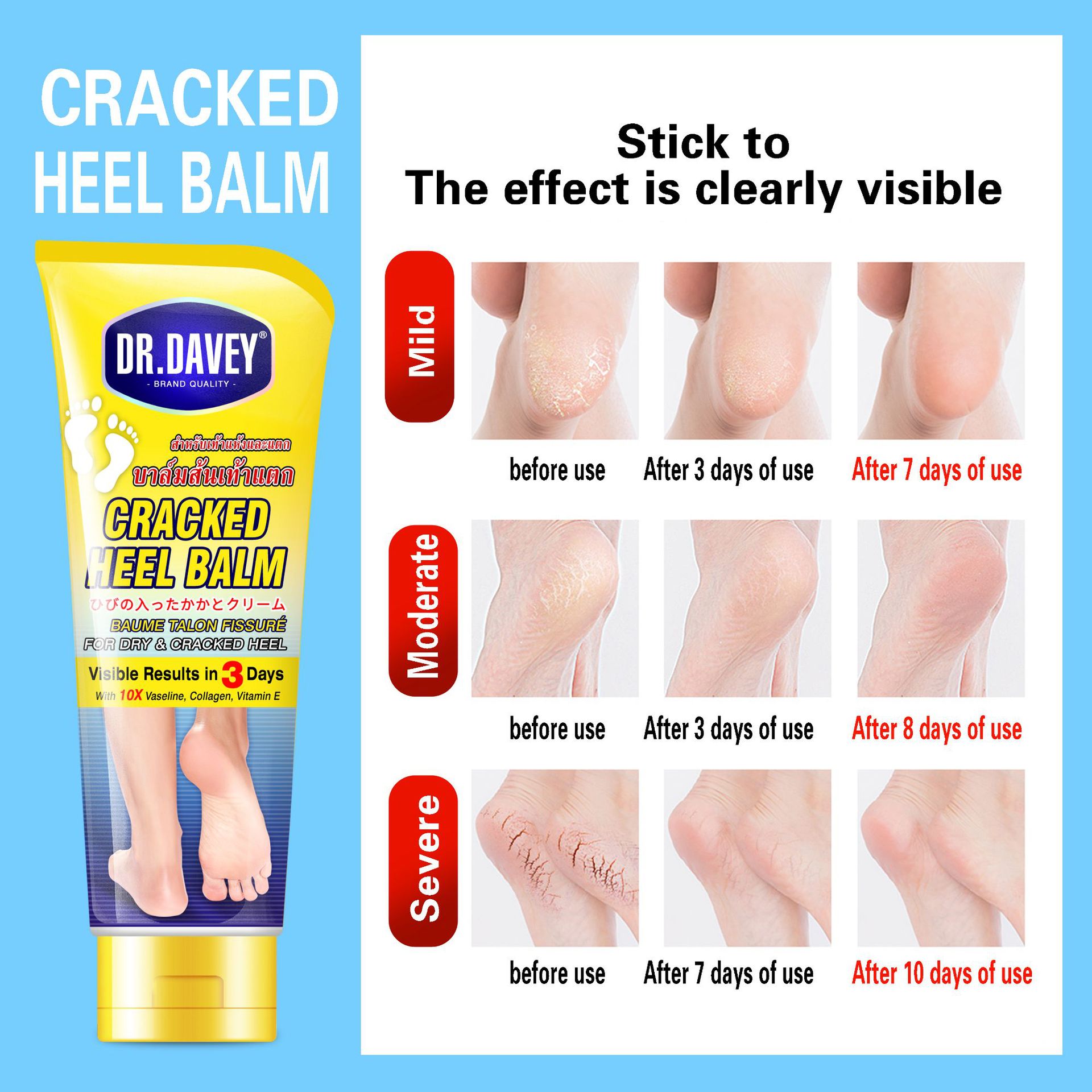 Cracked Heel Balm Moisturizing and Nourishing Protective Foot Cream pic 4
