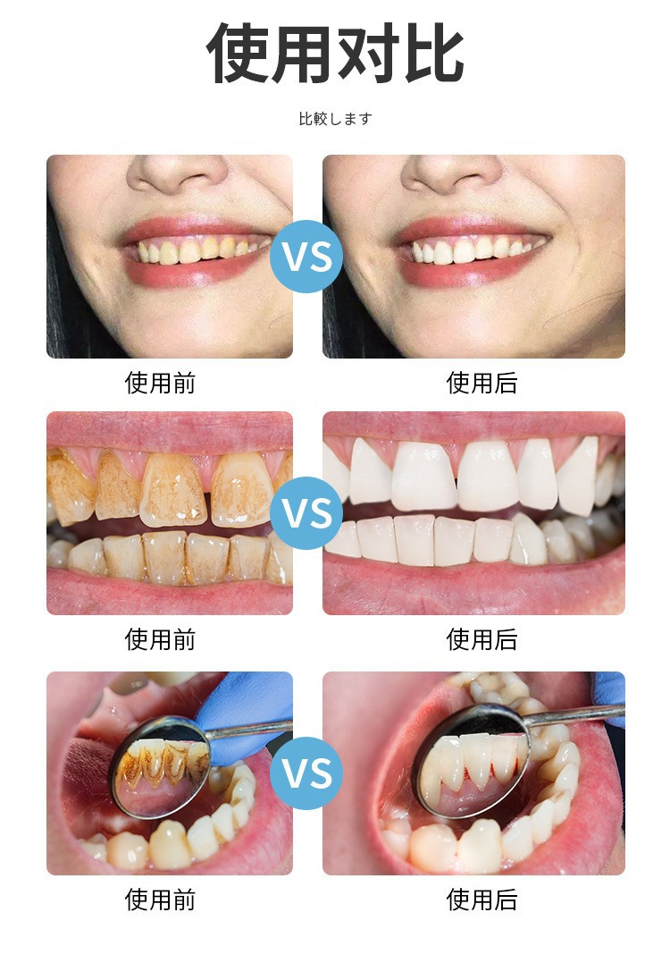 日本洁牙擦儿童去牙垢祛除牙黑斑牙渍神器牙齿菌斑微米橡皮海绵擦详情7