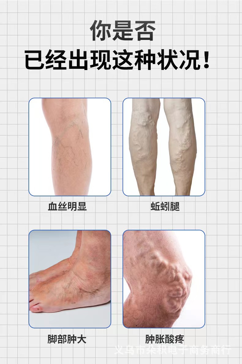 跨境外贸静脉修护贴缓解酸痛肿胀防止血管堵塞静脉保健贴工厂详情1