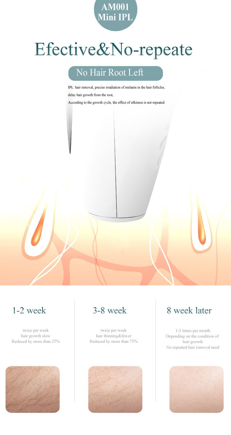 跨境热销脱毛仪手持激光脱毛仪家用女士无痛脱毛去腋毛全身脱毛器详情7