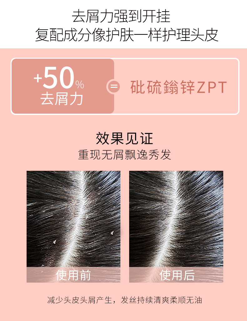 Factory wholesale anti-dandruff shampoo, nourishing oil control shampoo, perfume control, refreshing fragrance shampoo pic 7