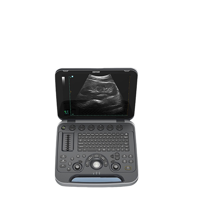 UL8 Medical human B-ultrasound machine, lithium battery, wireless laptop, color B-ultrasound machine Specification drawing