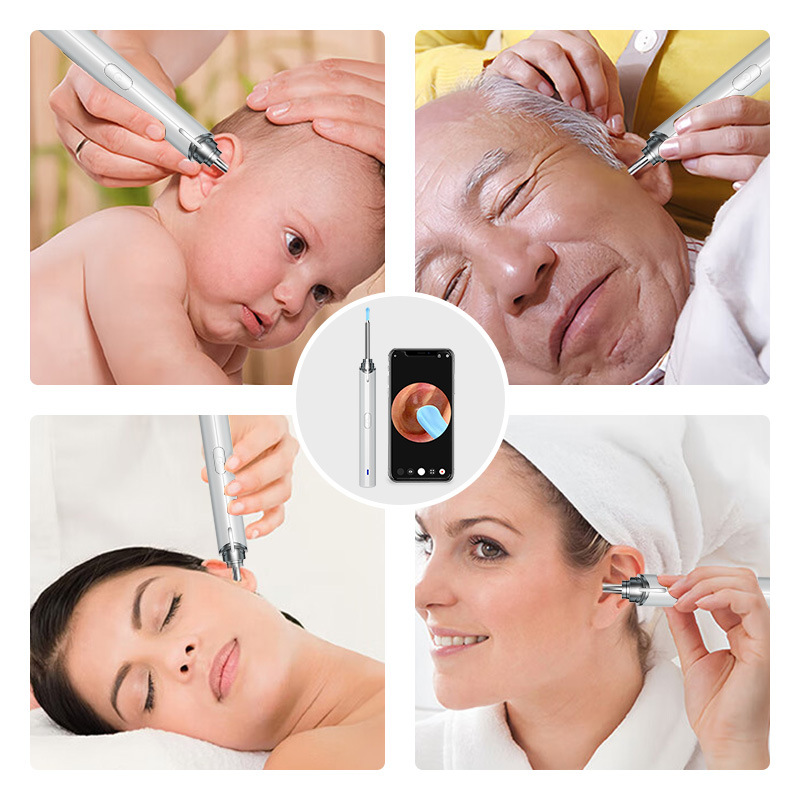 Cross-border new product AI visual ear pick, high-definition 304 stainless steel intelligent ear cleaning tool, visual and removable intelligent camera ear picker Item Picture