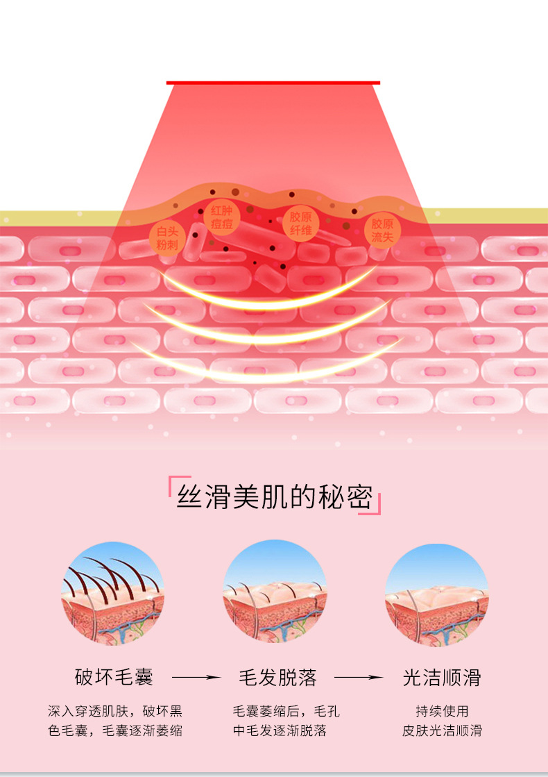 Handheld hair removal device for men and women, home photonic hair removal device, full-body IPL painless laser hair removal pic 5