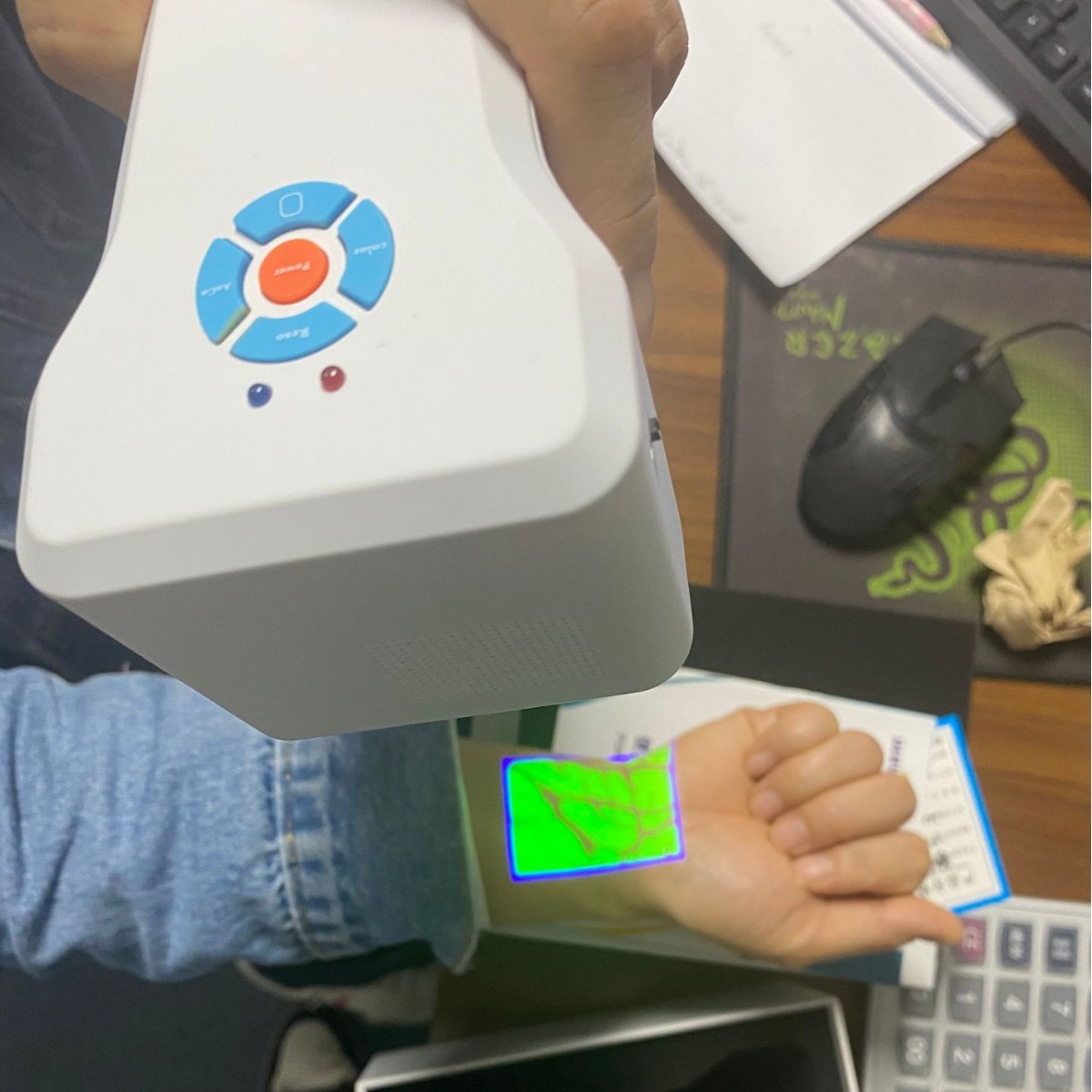 Specialized vascular imaging instrument for foreign trade, venous vessel search instrument, imaging instrument, venous display instrument, rechargeable handheld projector