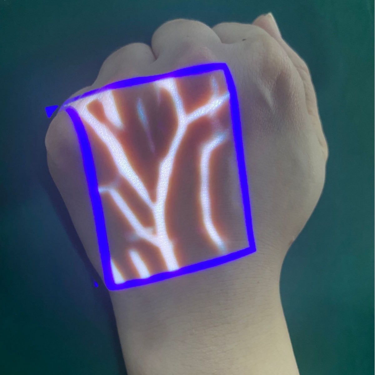 Specialized vascular imaging instrument for foreign trade, venous vessel search instrument, imaging instrument, venous display instrument, rechargeable handheld projector details Picture