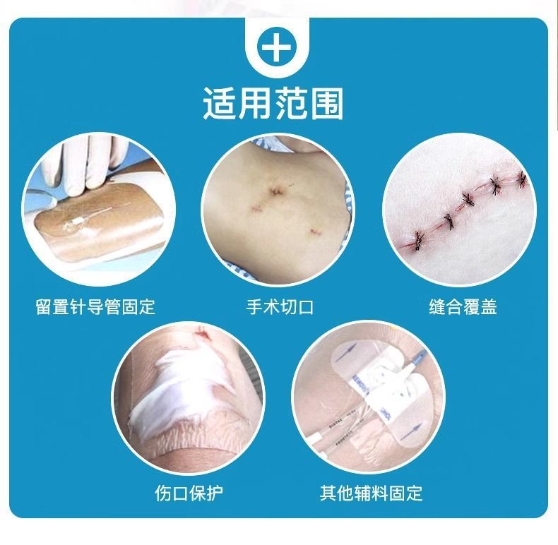 Miaoqiling Medical sterile waterproof transparent indwelling needle patch Wound drainage catheter dressing PICC venous catheterization fixation pic 1