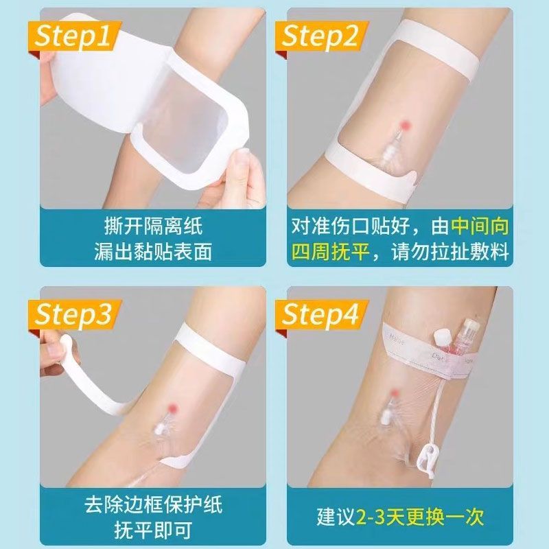 Miaoqiling Medical sterile waterproof transparent indwelling needle patch Wound drainage catheter dressing PICC venous catheterization fixation