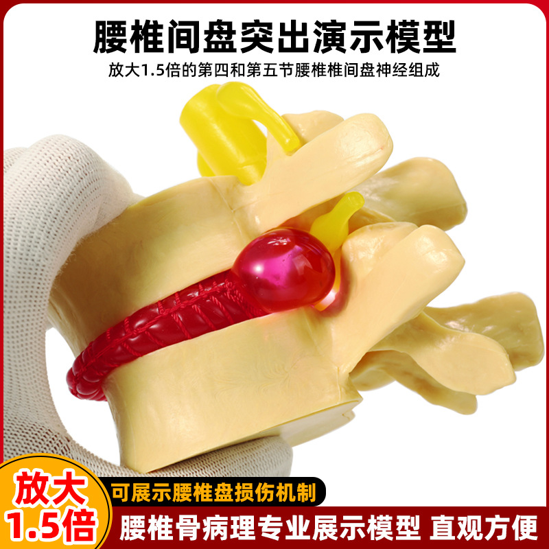 Genuine medical intervertebral disc model, human lumbar protrusion, spinal bone pathology demonstration, standard joint model Specification image