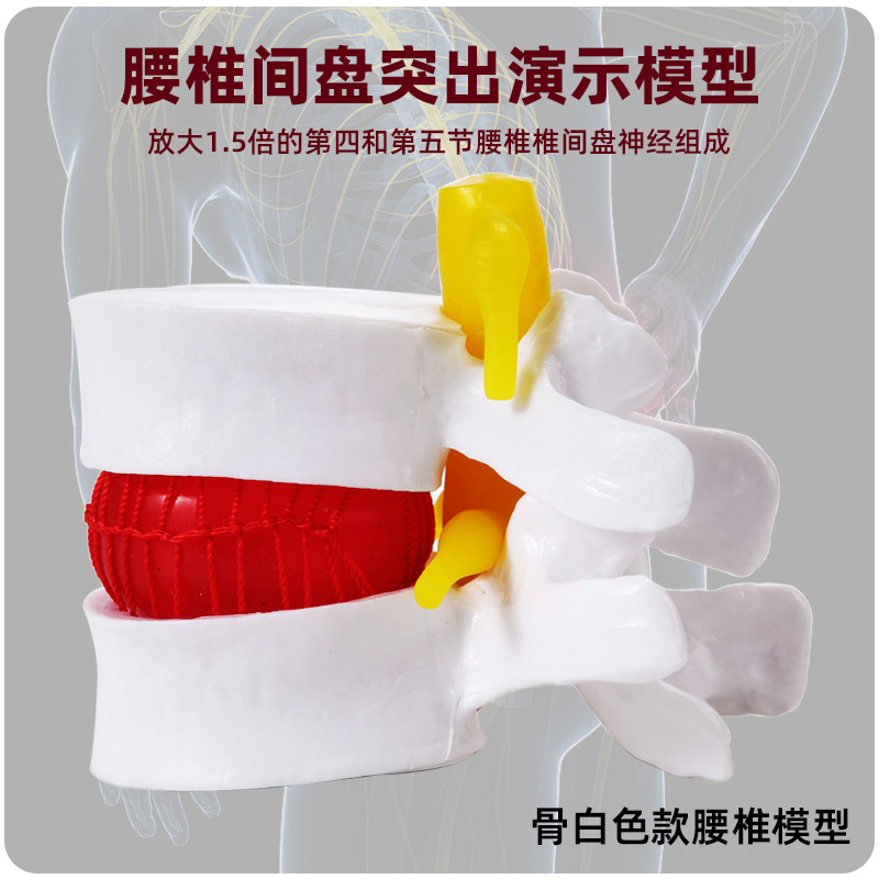 Genuine medical intervertebral disc model, human lumbar protrusion, spinal bone pathology demonstration, standard joint model Application Scenario