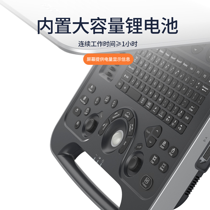 UL8 Medical human B-ultrasound machine, lithium battery, wireless laptop, color B-ultrasound machine Application Scenario