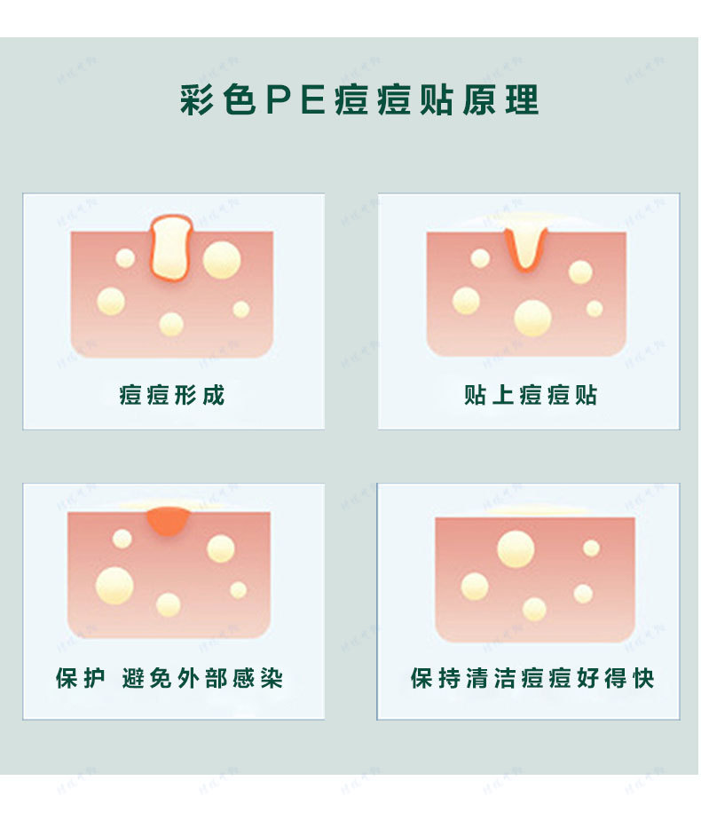 Colored acne patches, PE round skin tone acne patches, isolation and concealing acne patches pic 6