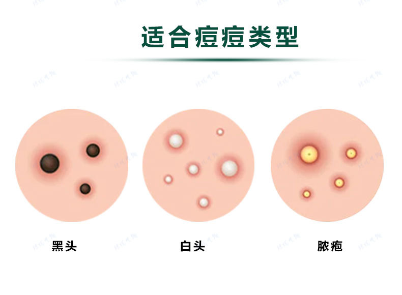 Colored acne patches, PE round skin tone acne patches, isolation and concealing acne patches pic 3