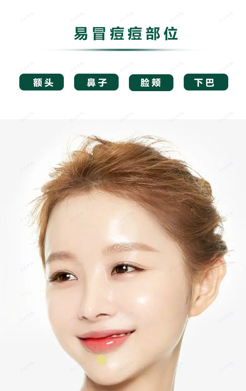 Colored acne patches, PE round skin tone acne patches, isolation and concealing acne patches pic 4