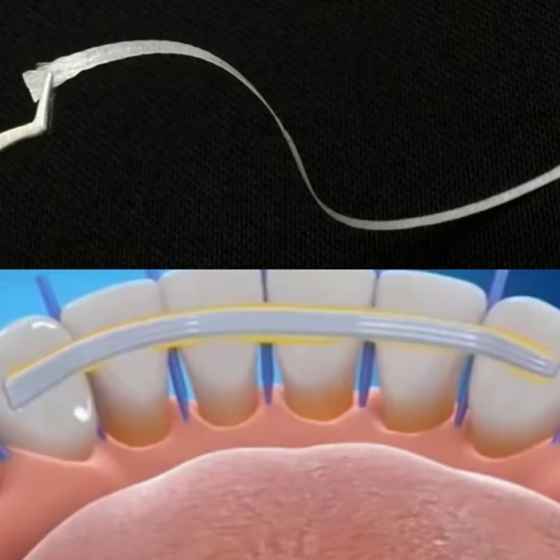 Foreign trade dental loose tooth fixing fiber tape USA is a material for maintaining the gap between loose teeth during repositioning pic 5