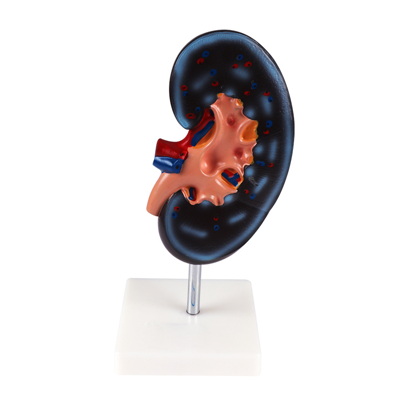 Human body model teaching model, kidney anatomy model pic 1