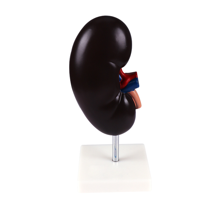 Human body model teaching model, kidney anatomy model pic 2