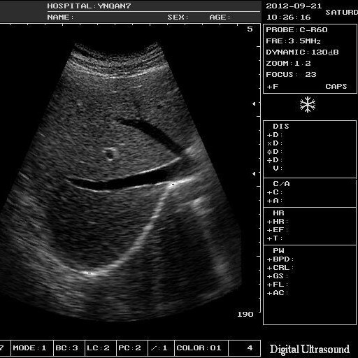 Foreign trade exclusive supply of portable black-and-white B-ultrasound machines for human and veterinary ultrasound equipment and examination instruments Specification drawing