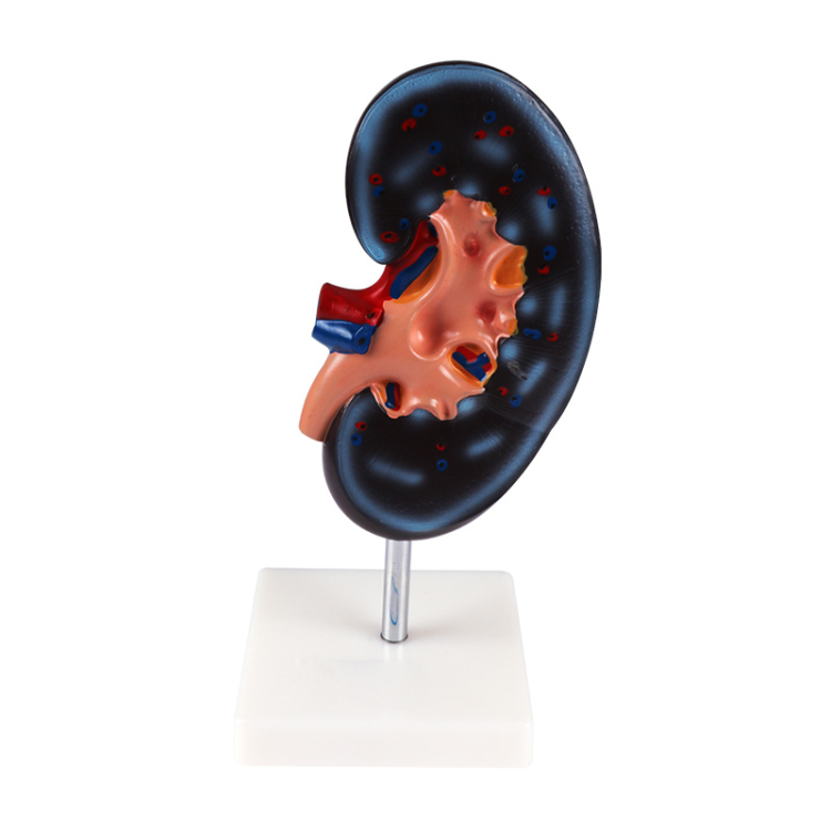 Human body model teaching model, kidney anatomy model