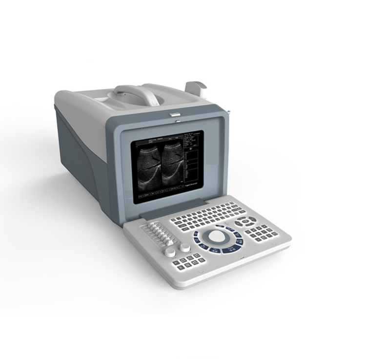 Foreign trade exclusive supply of portable black-and-white B-ultrasound machines for human and veterinary ultrasound equipment and examination instruments full figure