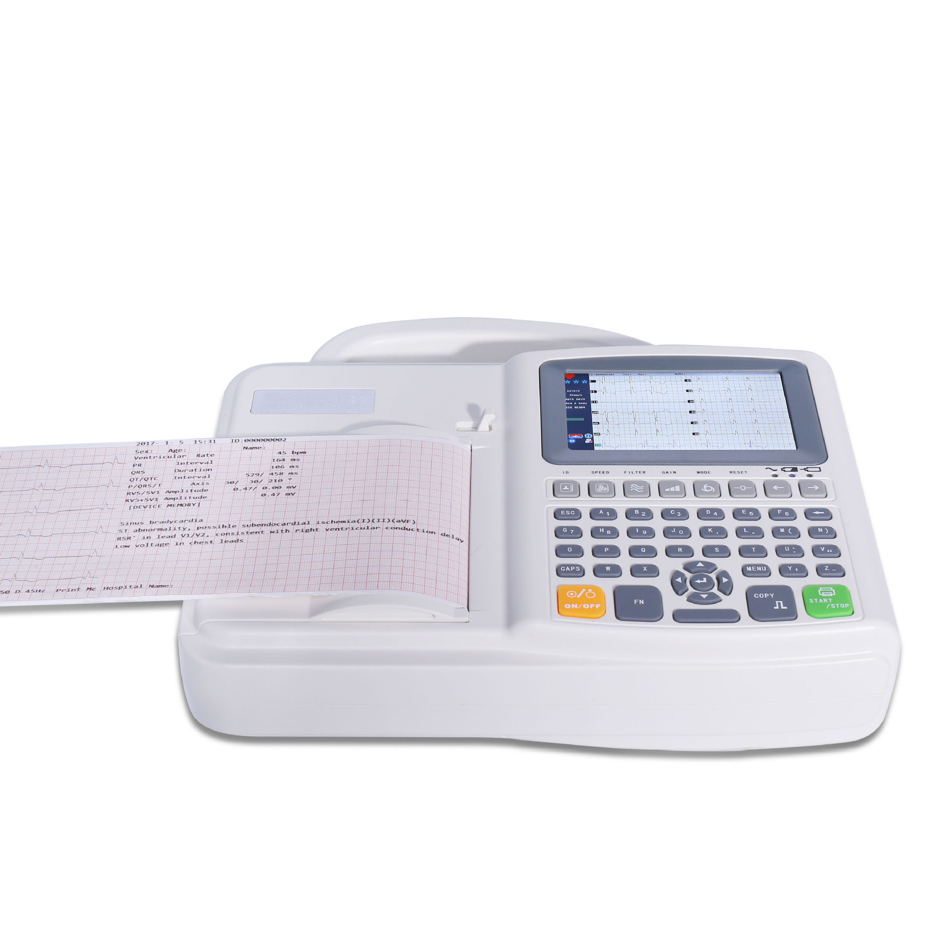 6-lead portable high-precision heart rate monitoring small electrocardiogram machine for export Application Scenario