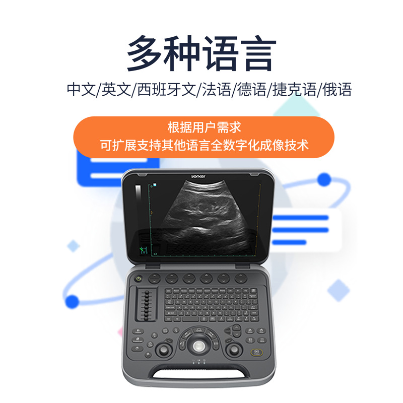 UL8 Medical human B-ultrasound machine, lithium battery, wireless laptop, color B-ultrasound machine details Picture