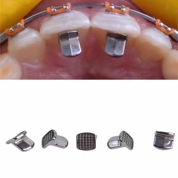 Foreign trade dental lingual baffle teeth straightener dental orthodontic bite plate disposable dental materials details Picture