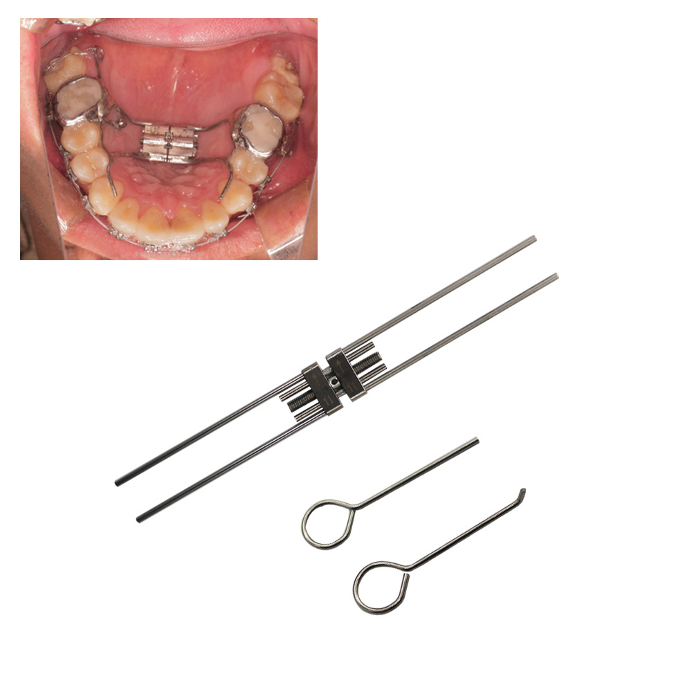 Foreign trade spiral arch expander, orthodontic stainless steel expansion screw, rapid palate expansion frame, dental arch wire material full figure