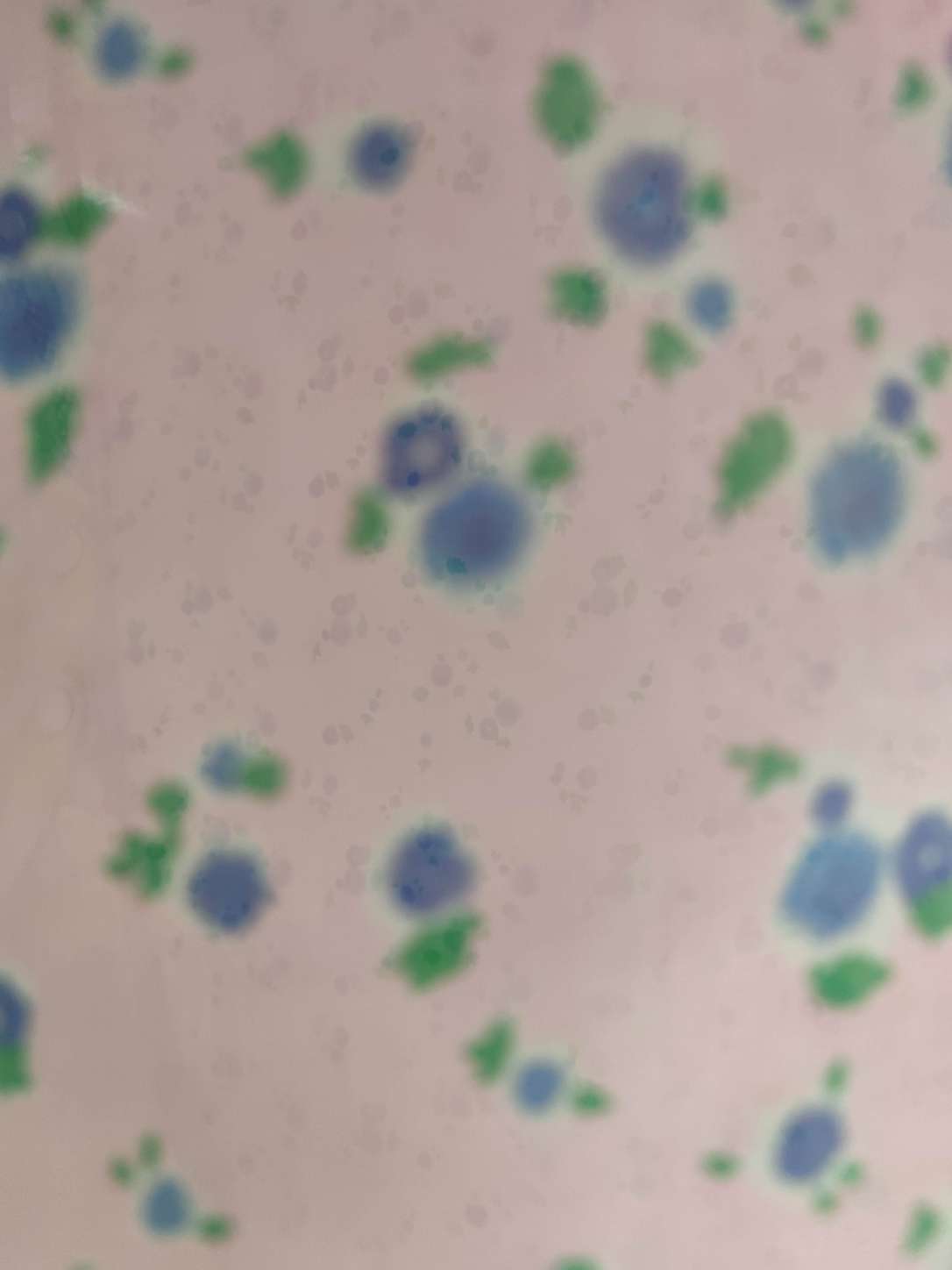 防蚊/透气/蚊帐细节图