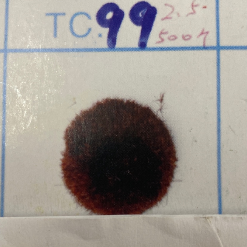 الشعر 99