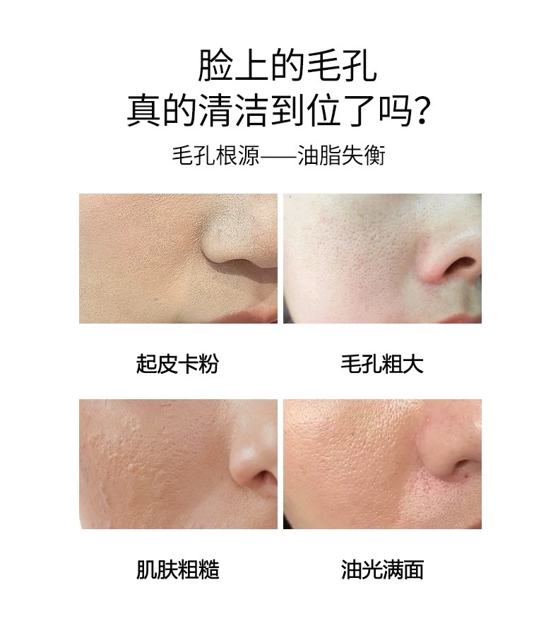 Spring Rain Honey Moisturizing Mask in 10-piece pack detail image 6