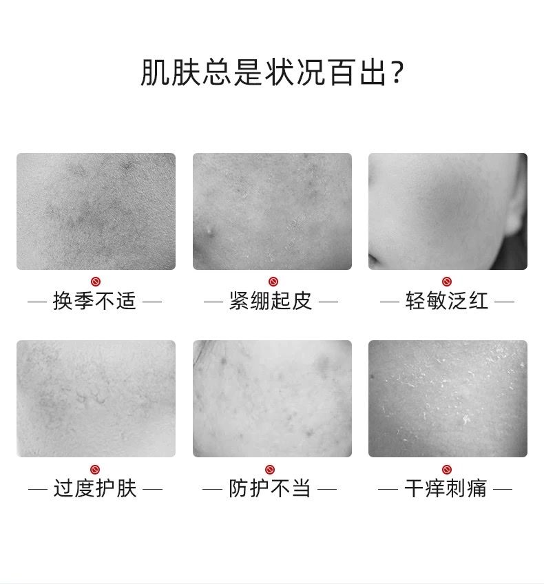 Fuerjia Centella asiatica Soothing and Repairing Patch 5-piece set detail image 2
