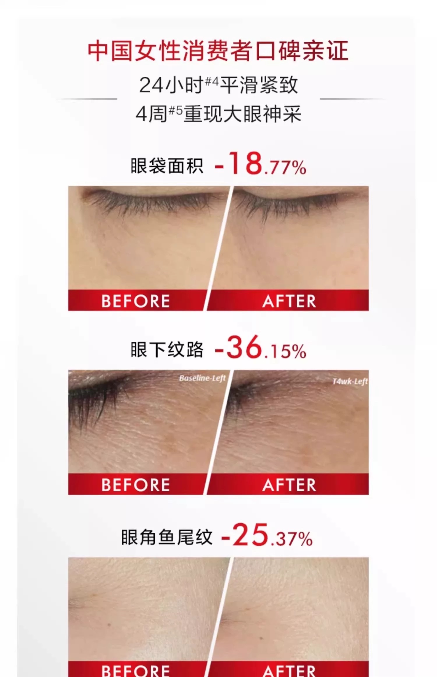 L 'Oreal's New Anti-Wrinkle and Firming Eye Cream for Rejuvenation 15ml detail image 4