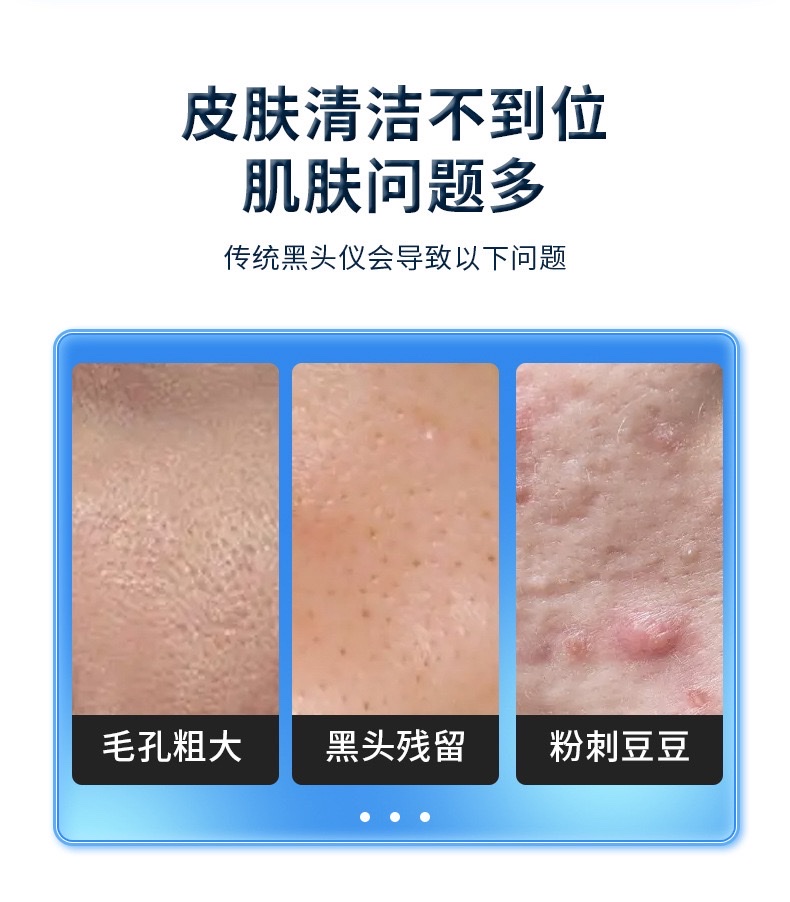 Small bubble home Blackhead removal beauty device, facial pore cleaning oxygenation instrument, electric moisturizing oxygenation detail image 4
