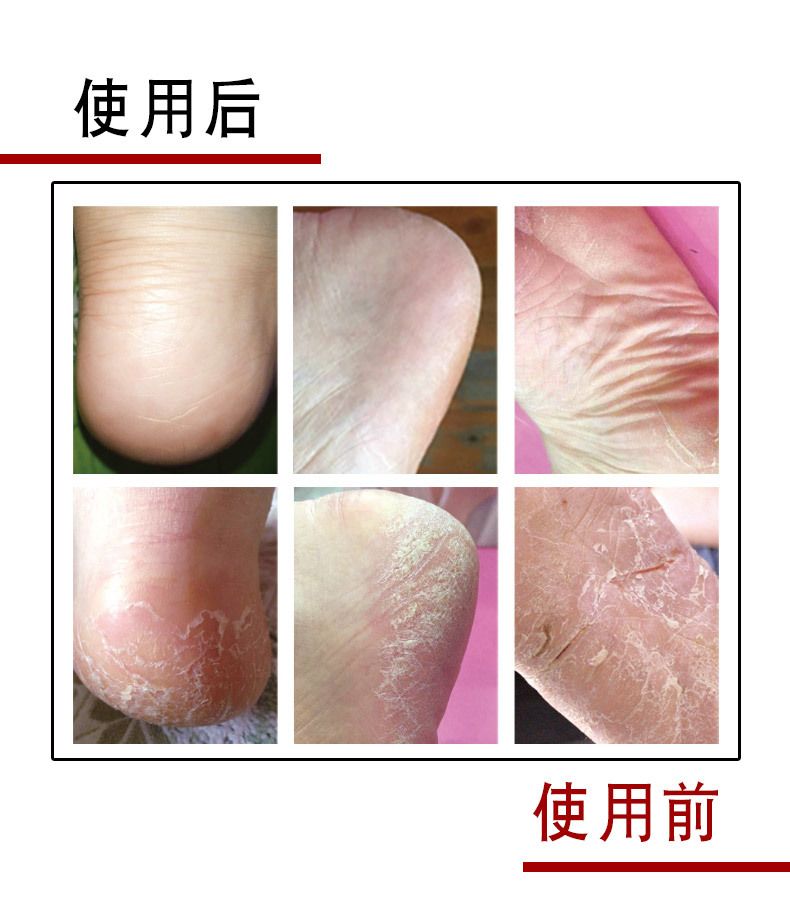 12 pairs of new autumn and winter anti-crack socks for both men and women, all-cotton mid-calf heel type socks to prevent dry feet and cracked feet for women detail image 1