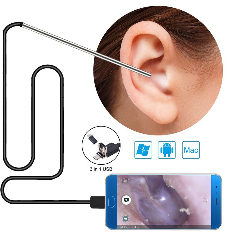 高清可视耳勺5.5mm耳道发光内窥镜1米数码可视耳镜详情图1