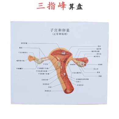 人体模型 女性生殖子宫模型 卵巢模型 病理变化科学教具详情图2