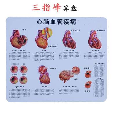 人体支脉粥样/硬化血栓/形成模型血管模型血液科动脉/硬化白底实物图