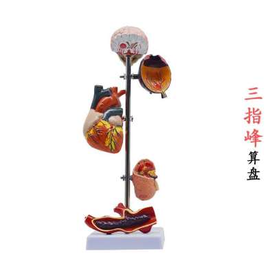 Display model of complications of glucose/urine disease high/blood pressure pathological changes display model