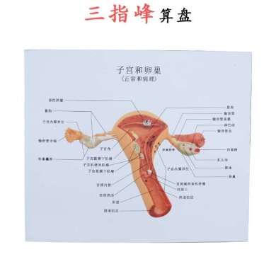 人体模型 女性生殖子宫模型 卵巢模型 病理变化科学教具产品图