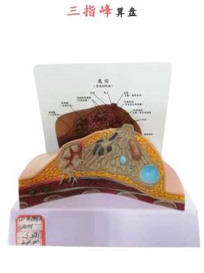 哺乳期模型 胸部解剖结构造乳腺病变模型