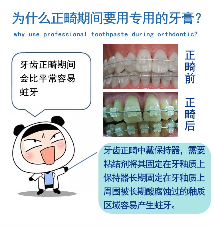 德国进口Colgate高露洁Dentagard牙膏草本薄荷直立按压式100ml详情图4